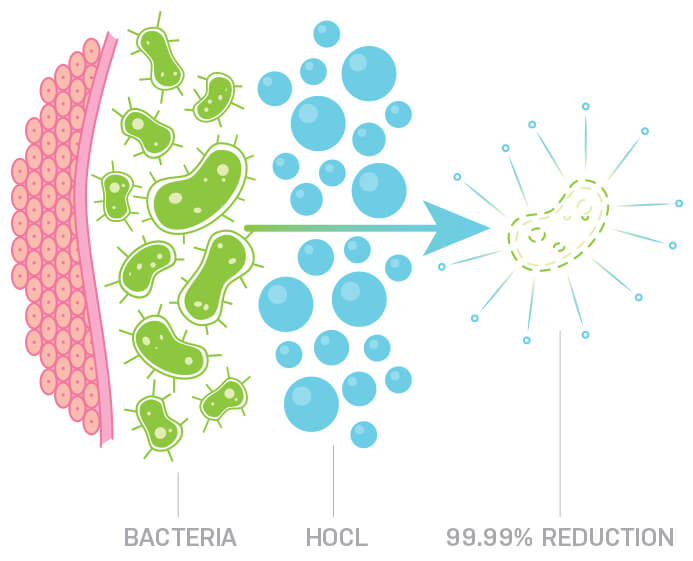 Bacteria versus HOCl